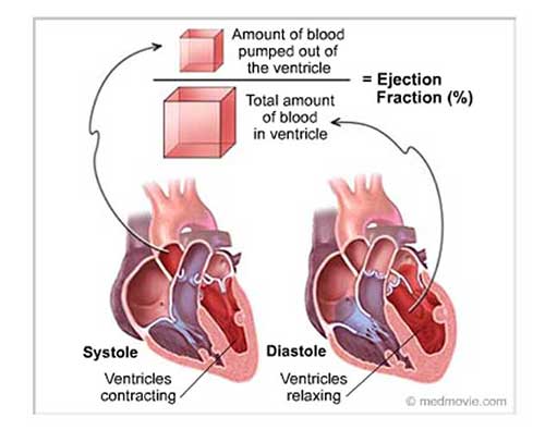 Ejection Fraction - Dr. VT Shah